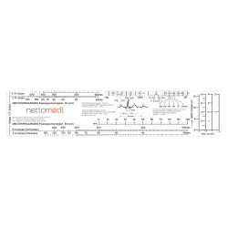 EKG-Lineal